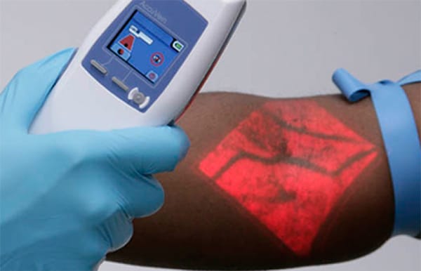 accuvein summary Request sample of market research report on global vein finder market research accuvein translite summary icrworld’s vein finder market research. accuvein summary Request sample of market research report on global vein finder market research accuvein translite summary icrworld’s vein finder market research.
